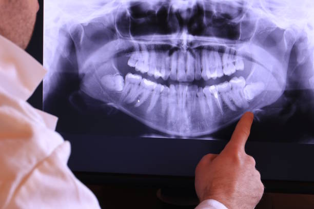 Best Broken or Chipped Tooth Repair in Richland Hills, TX