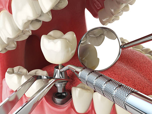 Best Emergency Orthodontic Repairs in Richland Hills, TX